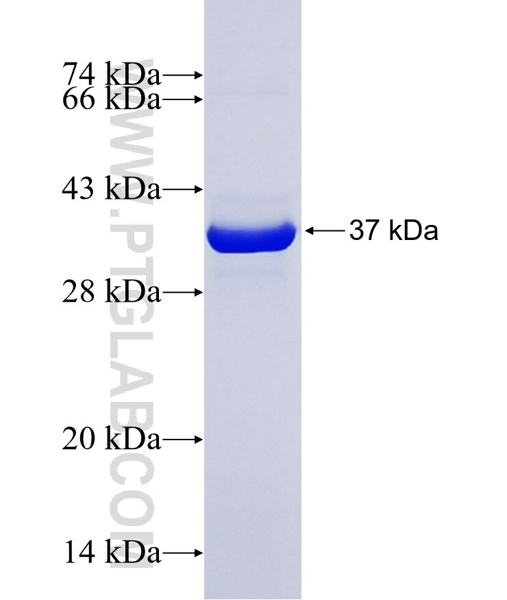 ACO2 fusion protein Ag17784 SDS-PAGE