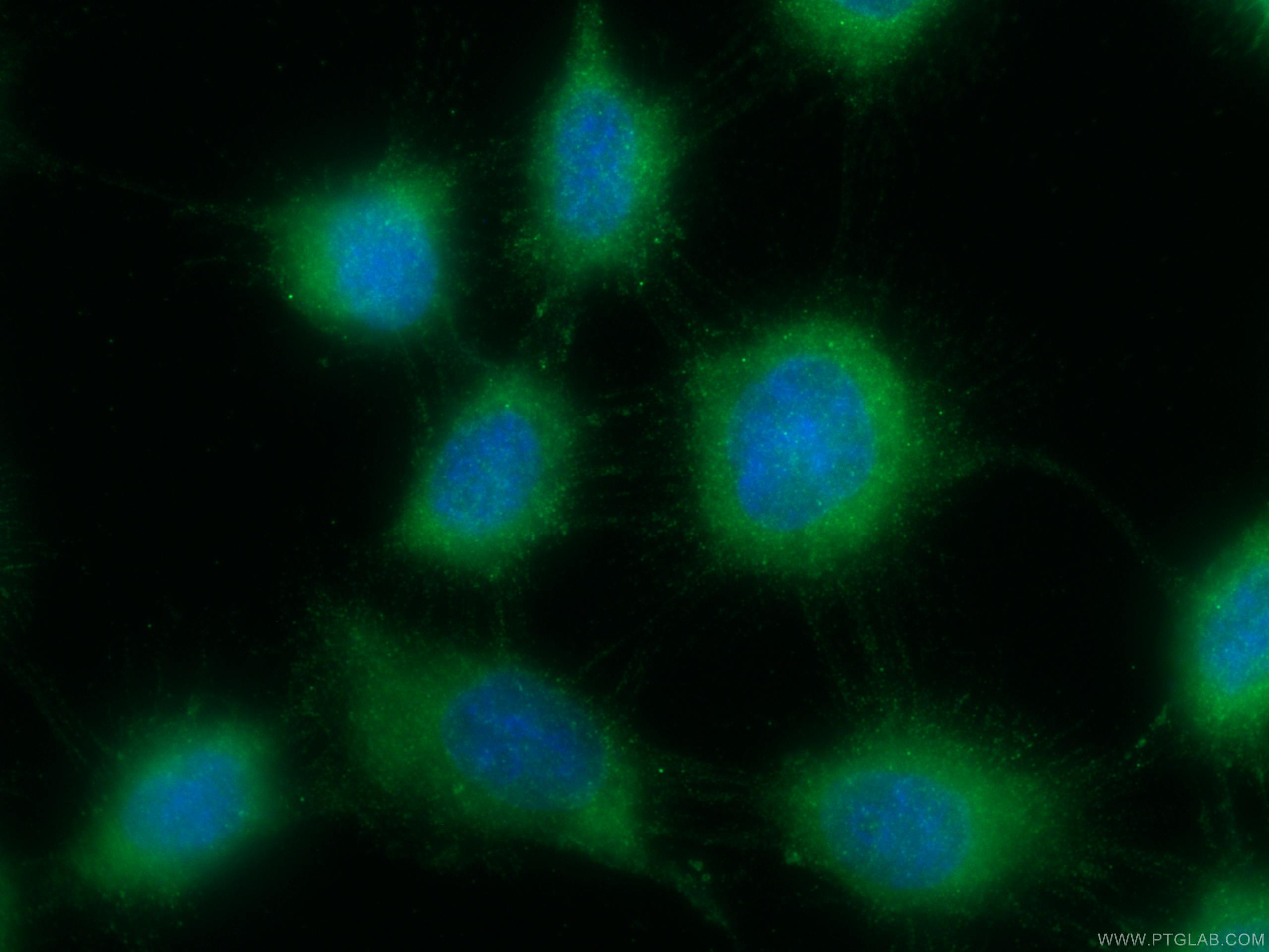 Immunofluorescence (IF) / fluorescent staining of A431 cells using ACOT11 Polyclonal antibody (10776-1-AP)