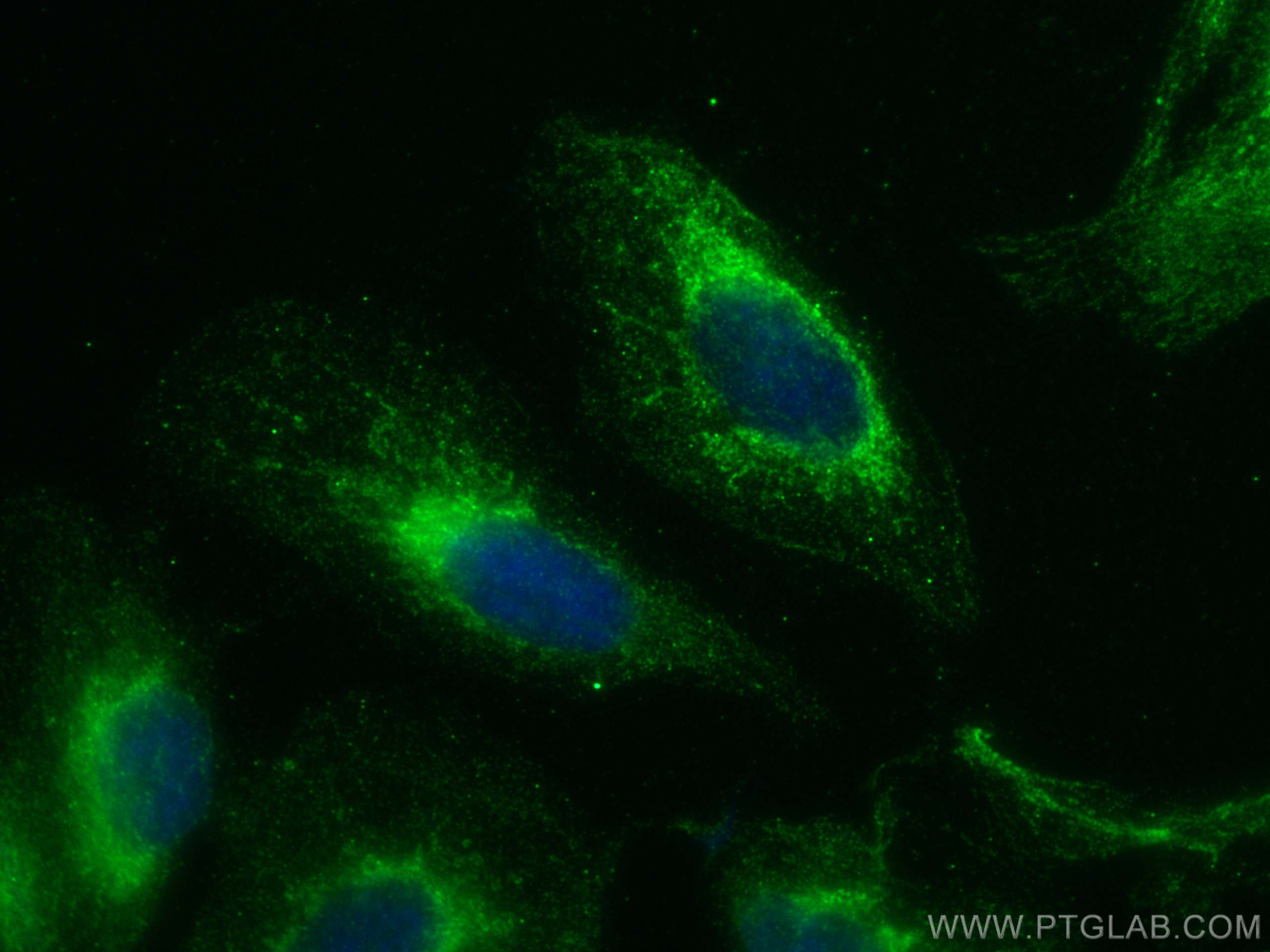Immunofluorescence (IF) / fluorescent staining of U2OS cells using ACOT11 Polyclonal antibody (10776-1-AP)