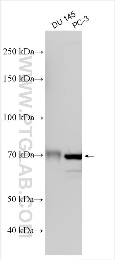 Western Blot (WB) analysis of various lysates using ACOT11 Polyclonal antibody (10776-1-AP)