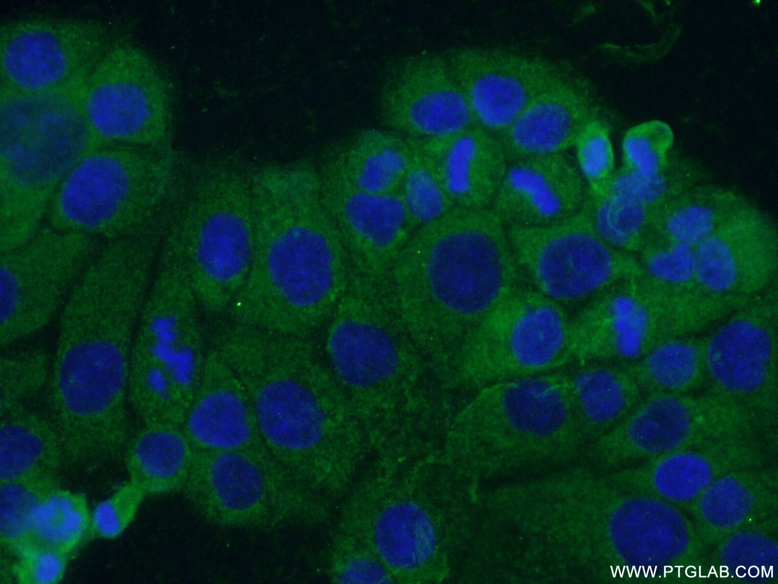 Immunofluorescence (IF) / fluorescent staining of COLO 320 cells using ACOT12 Polyclonal antibody (17871-1-AP)