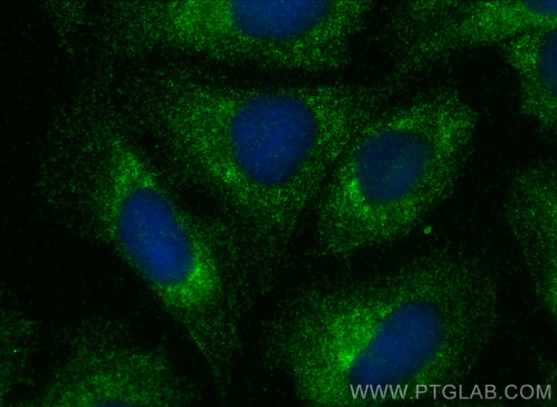 Immunofluorescence (IF) / fluorescent staining of U2OS cells using ACOT12 Polyclonal antibody (17871-1-AP)