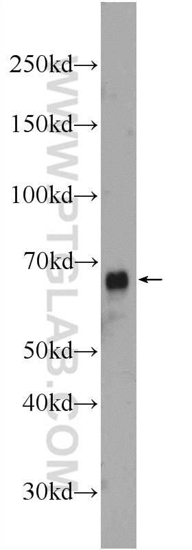 Western Blot (WB) analysis of COLO 320 cells using ACOT12 Polyclonal antibody (17871-1-AP)