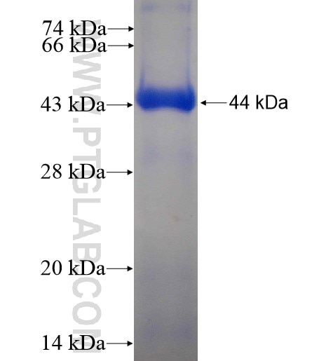 ACOT12 fusion protein Ag12529 SDS-PAGE