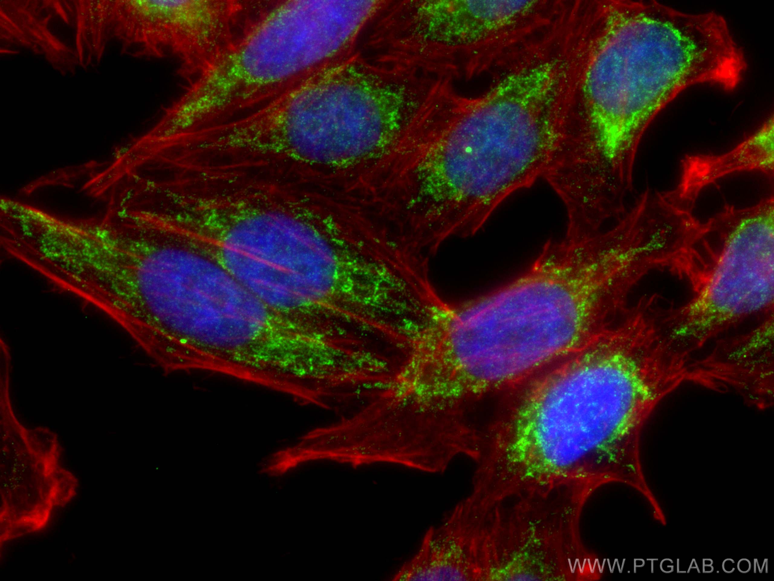 Immunofluorescence (IF) / fluorescent staining of HepG2 cells using ACOT2 Polyclonal antibody (15633-1-AP)