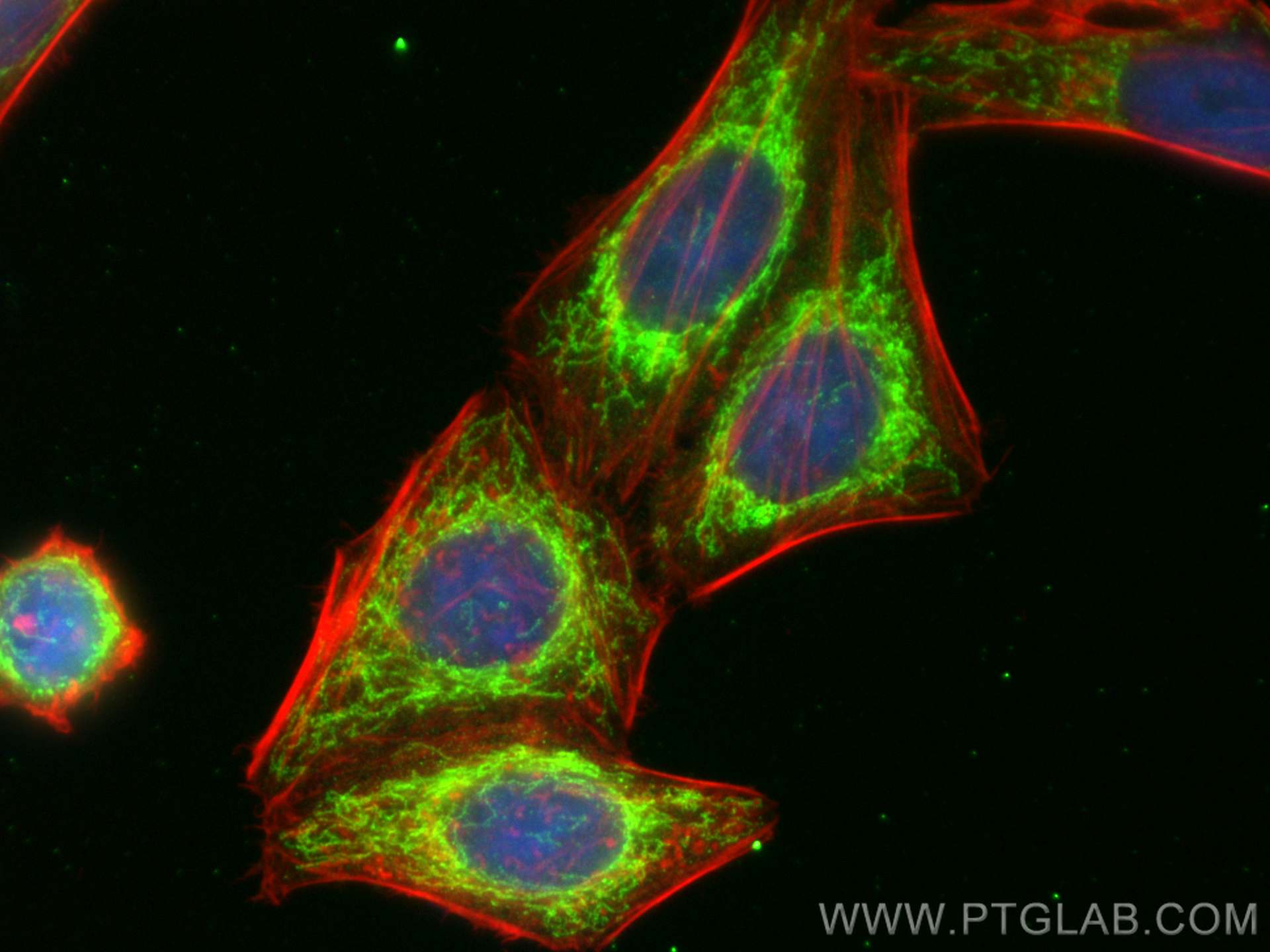 Immunofluorescence (IF) / fluorescent staining of HepG2 cells using ACOT2 Polyclonal antibody (15633-1-AP)