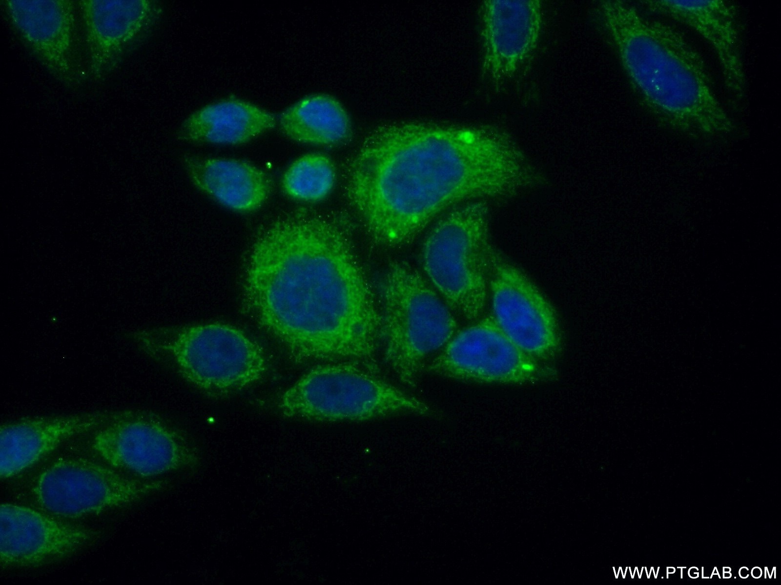Immunofluorescence (IF) / fluorescent staining of HepG2 cells using ACOT2 Polyclonal antibody (15633-1-AP)