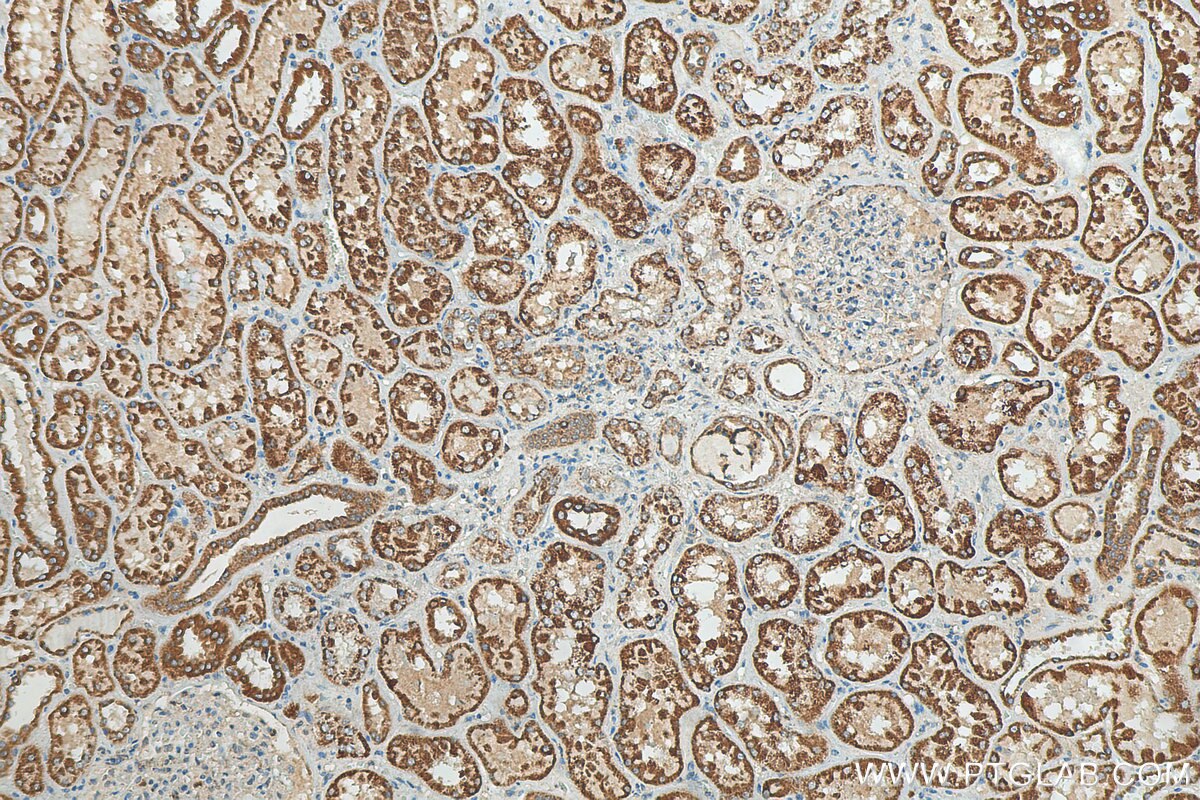 Immunohistochemistry (IHC) staining of human kidney tissue using ACOT2 Polyclonal antibody (15633-1-AP)