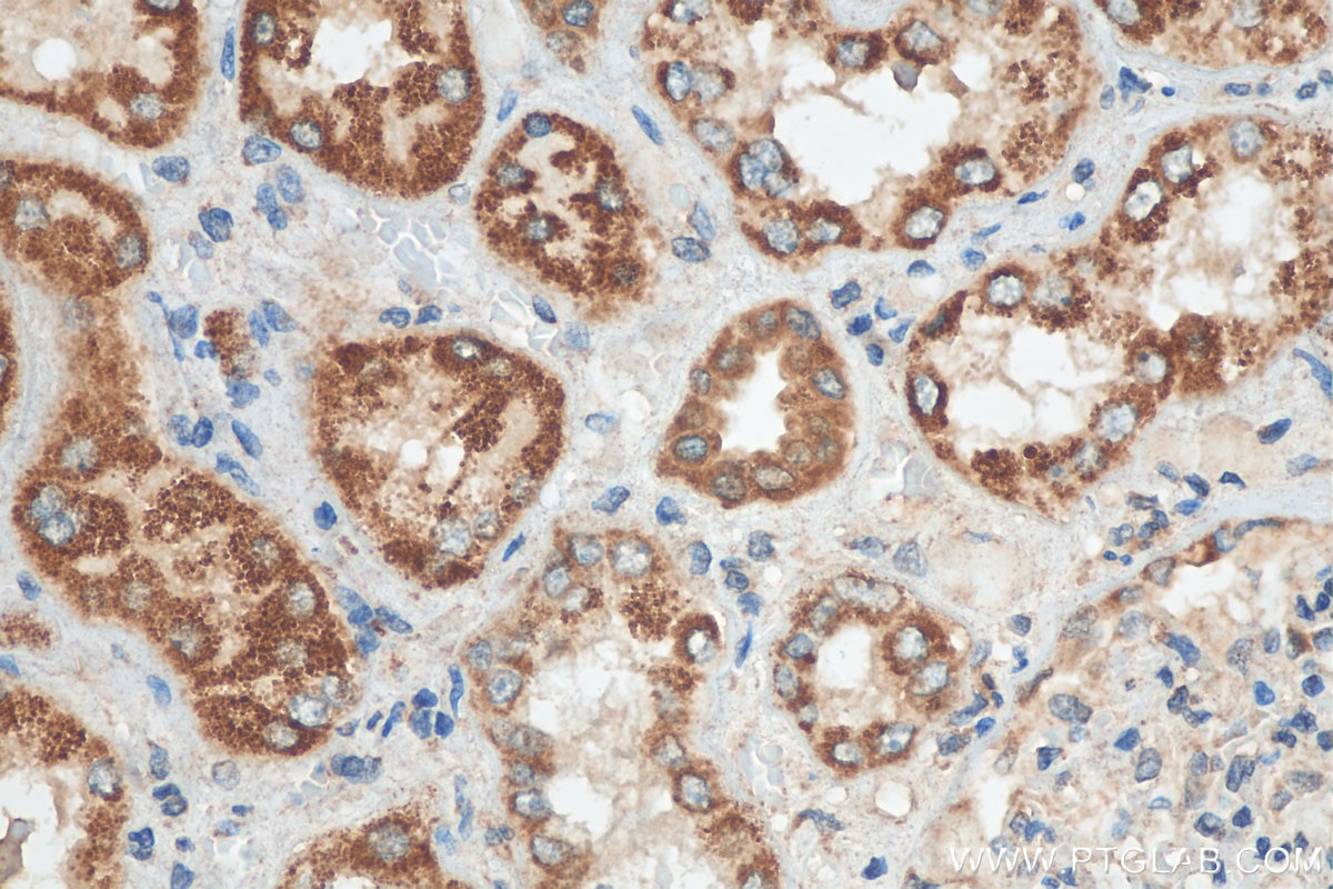 Immunohistochemistry (IHC) staining of human kidney tissue using ACOT2 Polyclonal antibody (15633-1-AP)