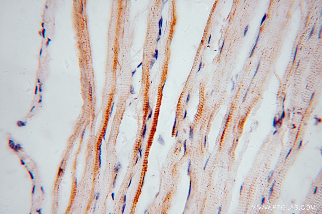 Immunohistochemistry (IHC) staining of human skeletal muscle tissue using ACOT2 Polyclonal antibody (15633-1-AP)