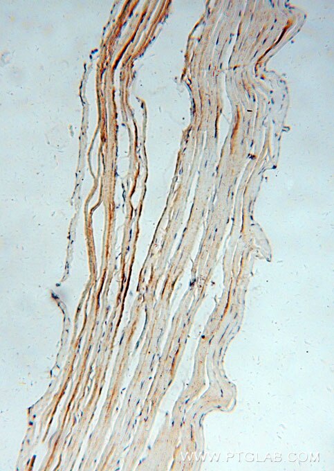 IHC staining of human skeletal muscle using 15633-1-AP