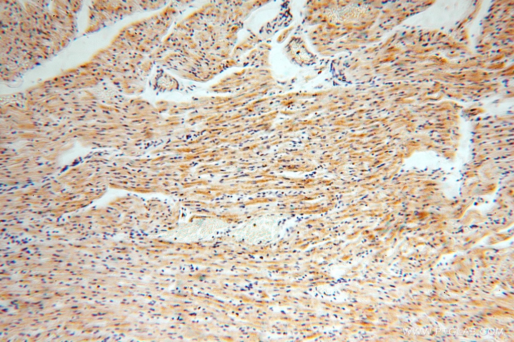 Immunohistochemistry (IHC) staining of human heart tissue using ACOT2 Polyclonal antibody (15633-1-AP)