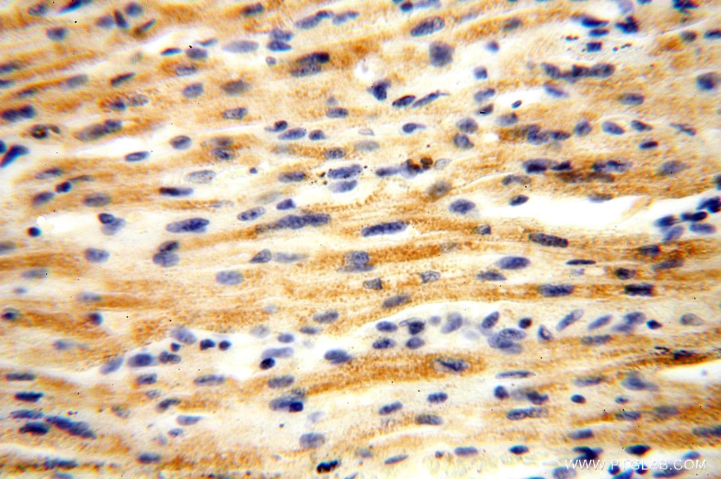 Immunohistochemistry (IHC) staining of human heart tissue using ACOT2 Polyclonal antibody (15633-1-AP)