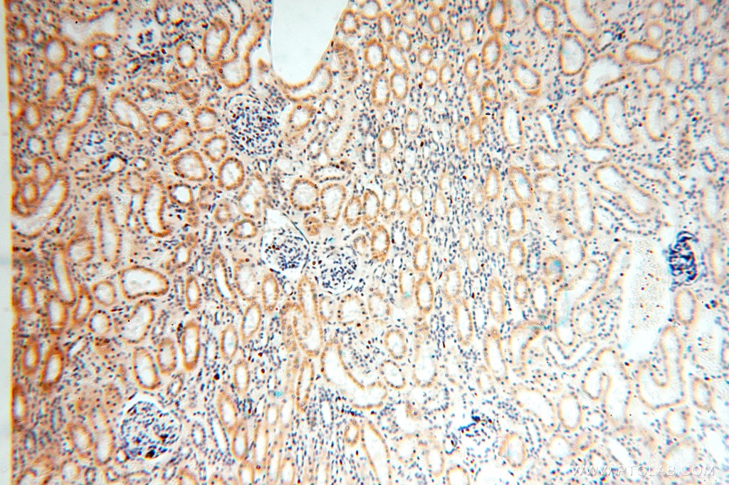 IHC staining of human kidney using 15633-1-AP