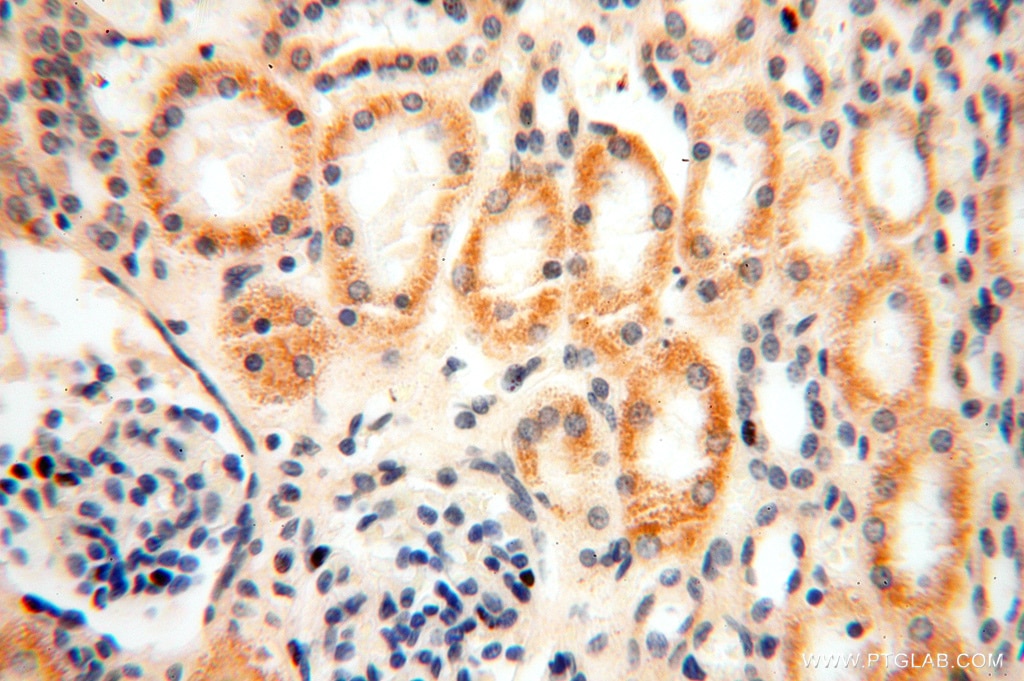 Immunohistochemistry (IHC) staining of human kidney tissue using ACOT2 Polyclonal antibody (15633-1-AP)