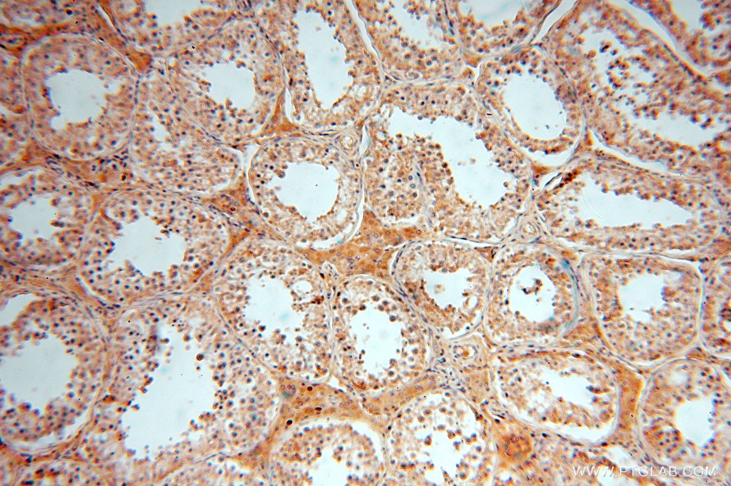 Immunohistochemistry (IHC) staining of human testis tissue using ACOT2 Polyclonal antibody (15633-1-AP)