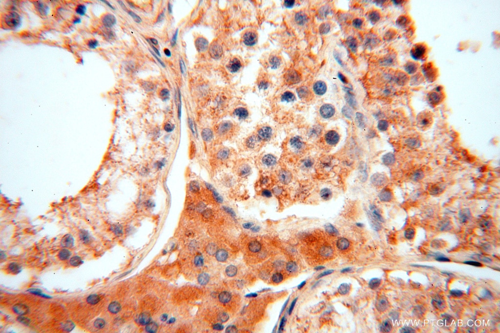 Immunohistochemistry (IHC) staining of human testis tissue using ACOT2 Polyclonal antibody (15633-1-AP)