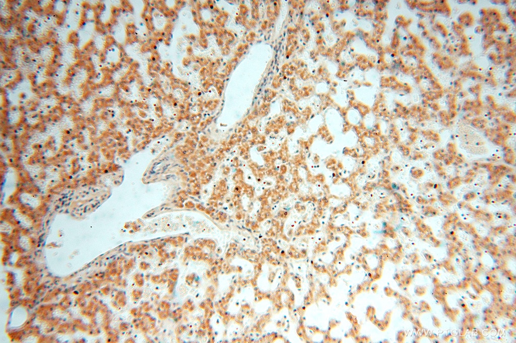 Immunohistochemistry (IHC) staining of human liver tissue using ACOT2 Polyclonal antibody (15633-1-AP)