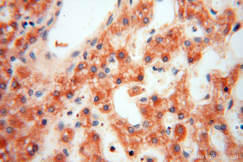 Immunohistochemistry (IHC) staining of human liver tissue using ACOT2 Polyclonal antibody (15633-1-AP)