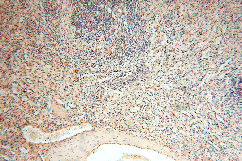 Immunohistochemistry (IHC) staining of human spleen tissue using ACOT2 Polyclonal antibody (15633-1-AP)