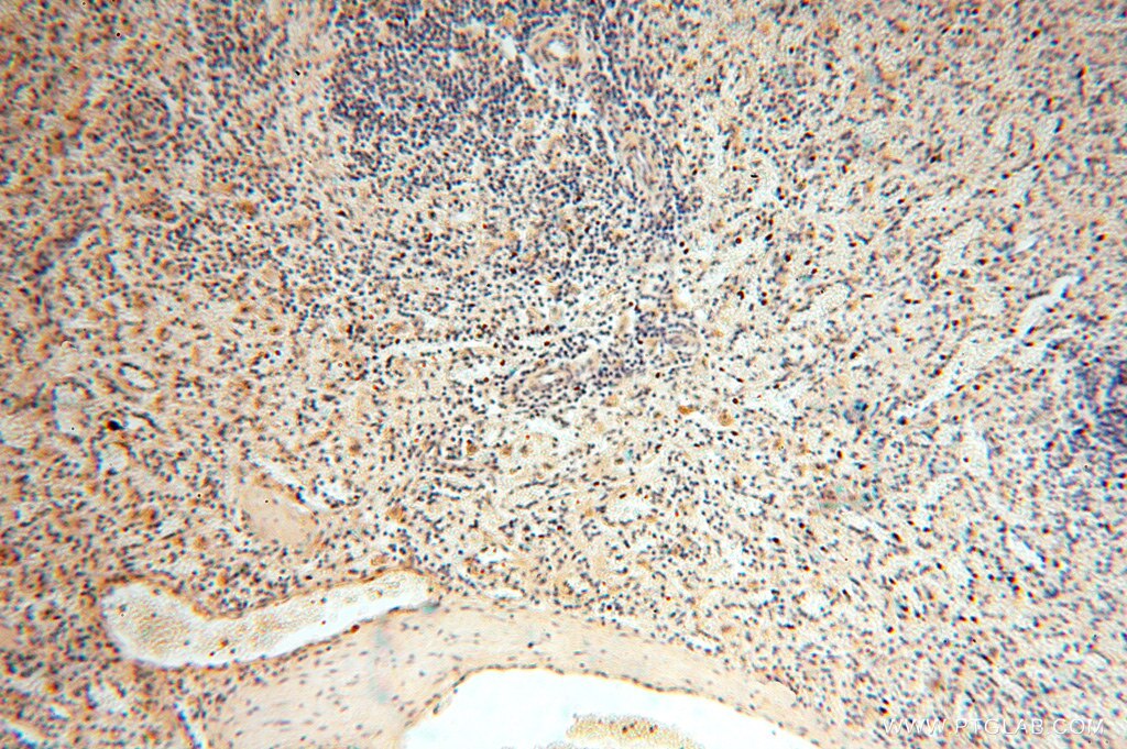 IHC staining of human spleen using 15633-1-AP