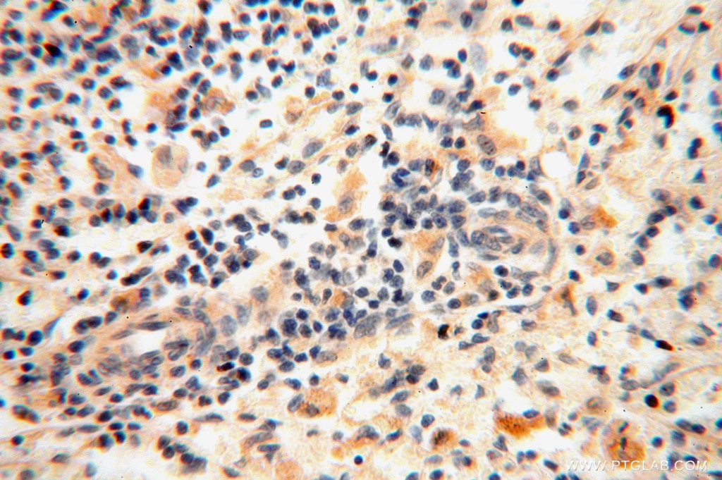 Immunohistochemistry (IHC) staining of human spleen tissue using ACOT2 Polyclonal antibody (15633-1-AP)