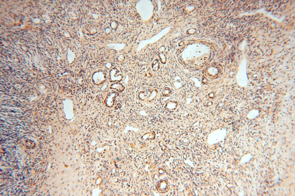 Immunohistochemistry (IHC) staining of human ovary tissue using ACOT2 Polyclonal antibody (15633-1-AP)