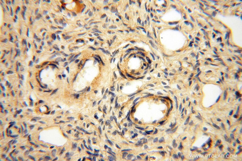 IHC staining of human ovary using 15633-1-AP