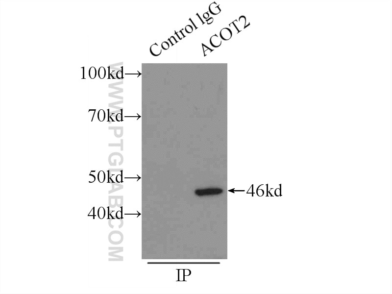 Immunoprecipitation (IP) experiment of HepG2 cells using ACOT2 Polyclonal antibody (15633-1-AP)