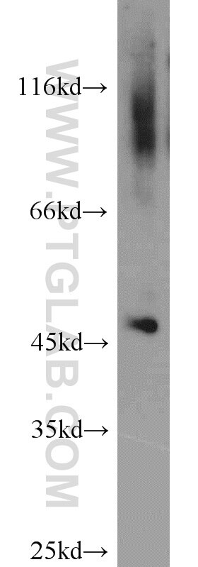 Western Blot (WB) analysis of human testis tissue using ACOT2 Polyclonal antibody (15633-1-AP)