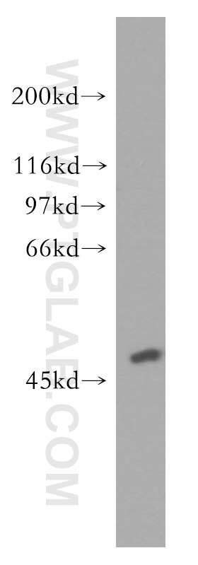 Western Blot (WB) analysis of human brain tissue using ACOT2 Polyclonal antibody (15633-1-AP)