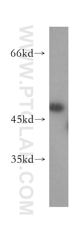 Western Blot (WB) analysis of human kidney tissue using ACOT2 Polyclonal antibody (15633-1-AP)