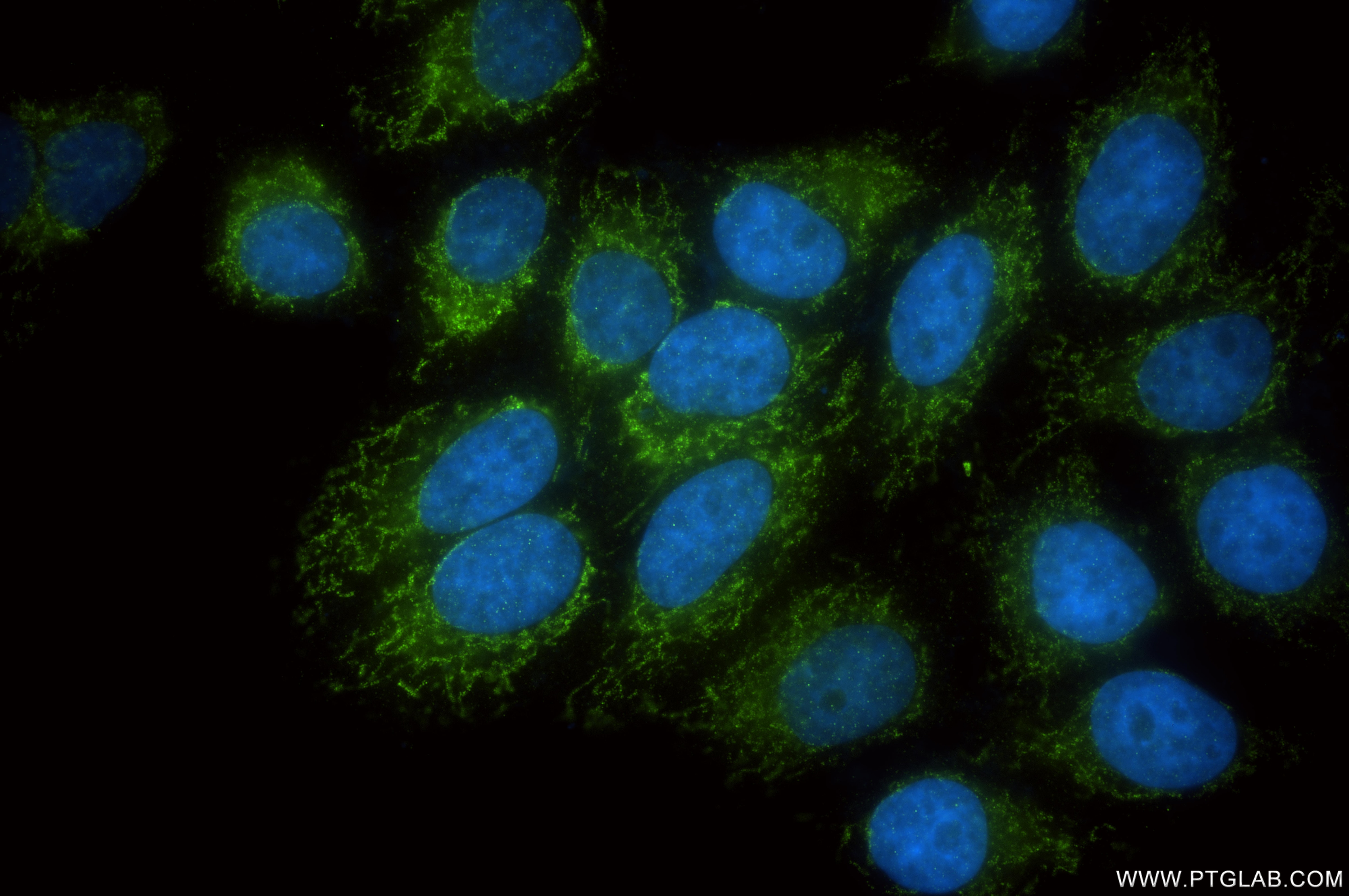 Immunofluorescence (IF) / fluorescent staining of HepG2 cells using ACOT1/2 Recombinant monoclonal antibody (82122-5-RR)