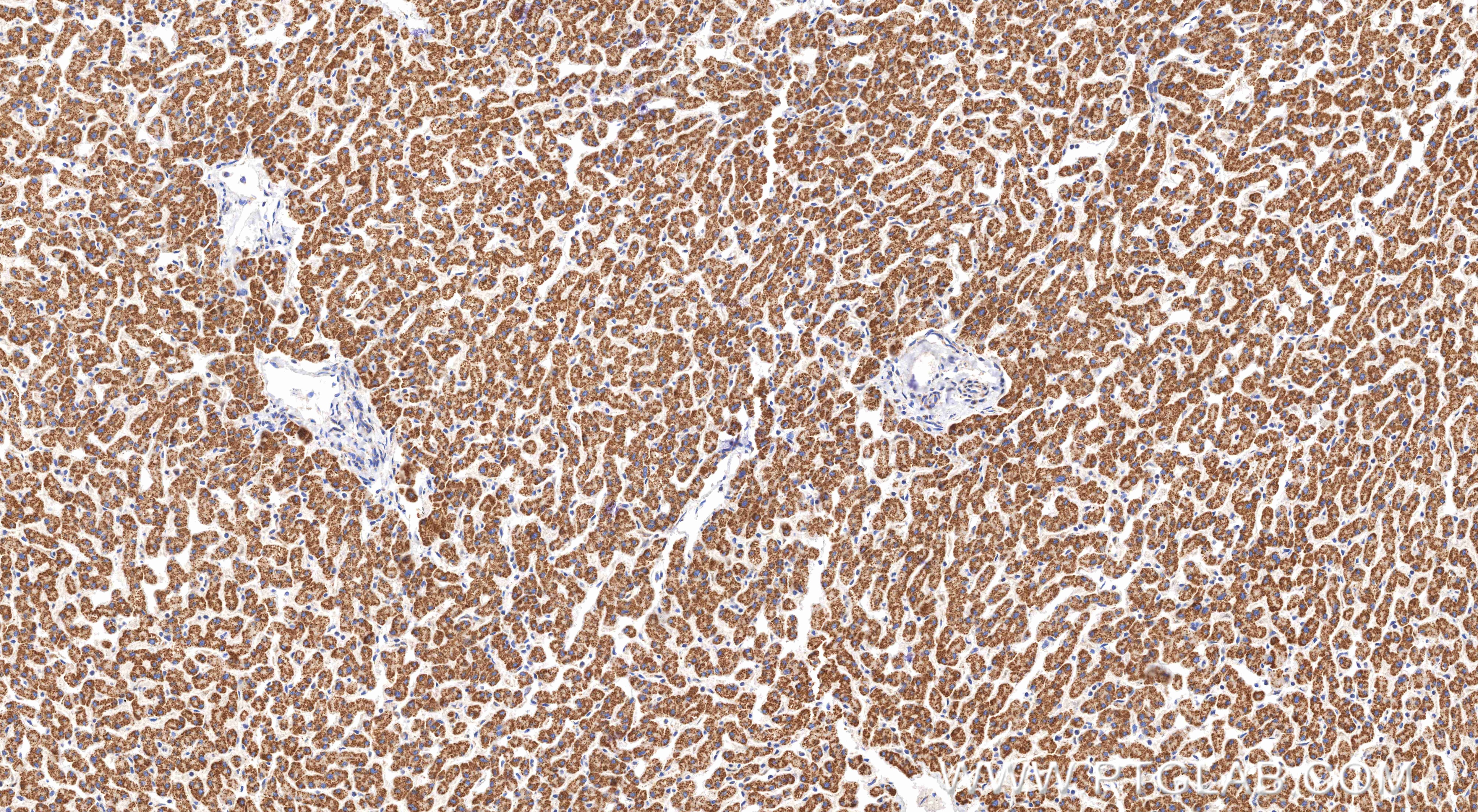 Immunohistochemistry (IHC) staining of human liver tissue using ACOT1/2 Recombinant monoclonal antibody (82122-5-RR)