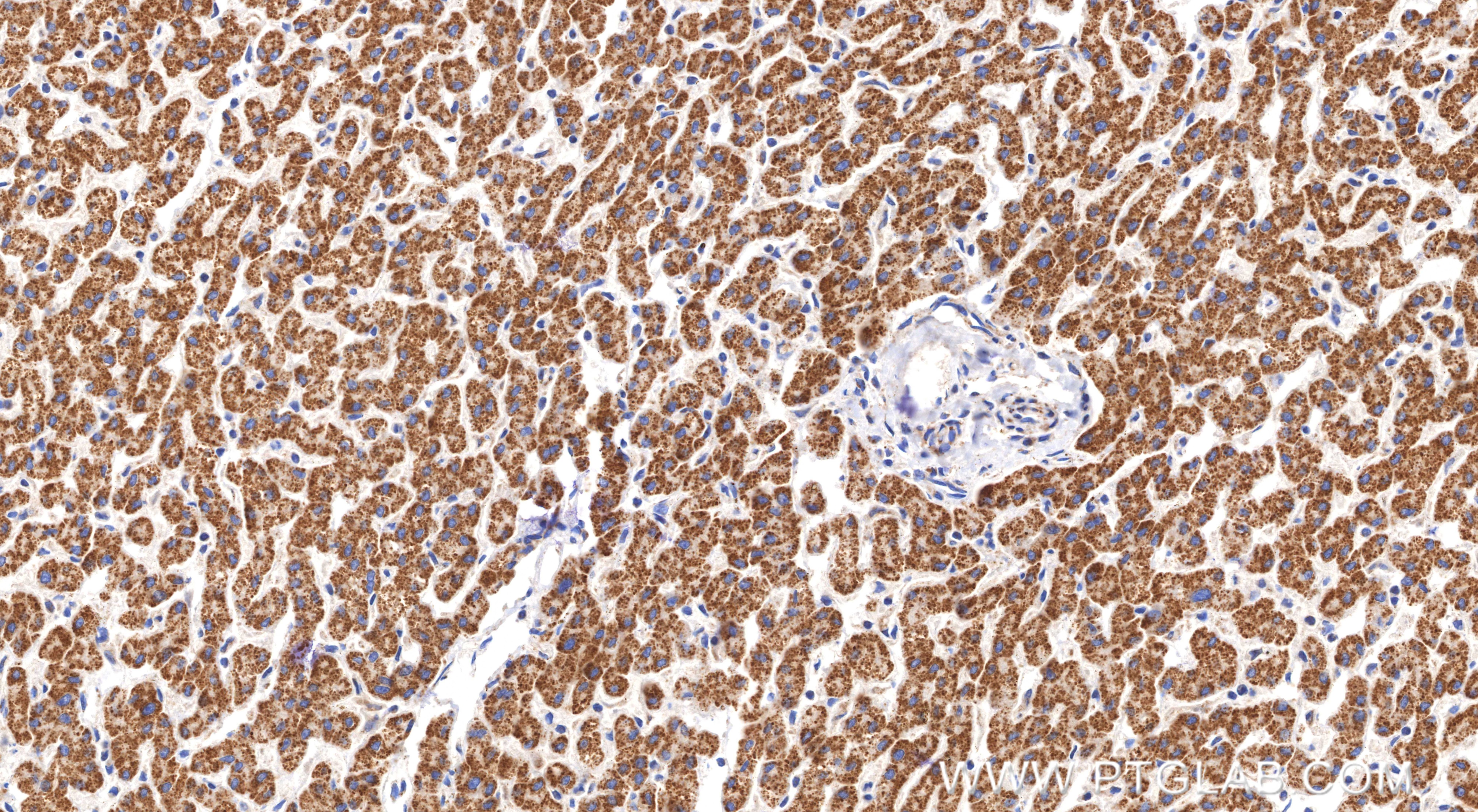 Immunohistochemistry (IHC) staining of human liver tissue using ACOT2 Recombinant monoclonal antibody (82122-5-RR)