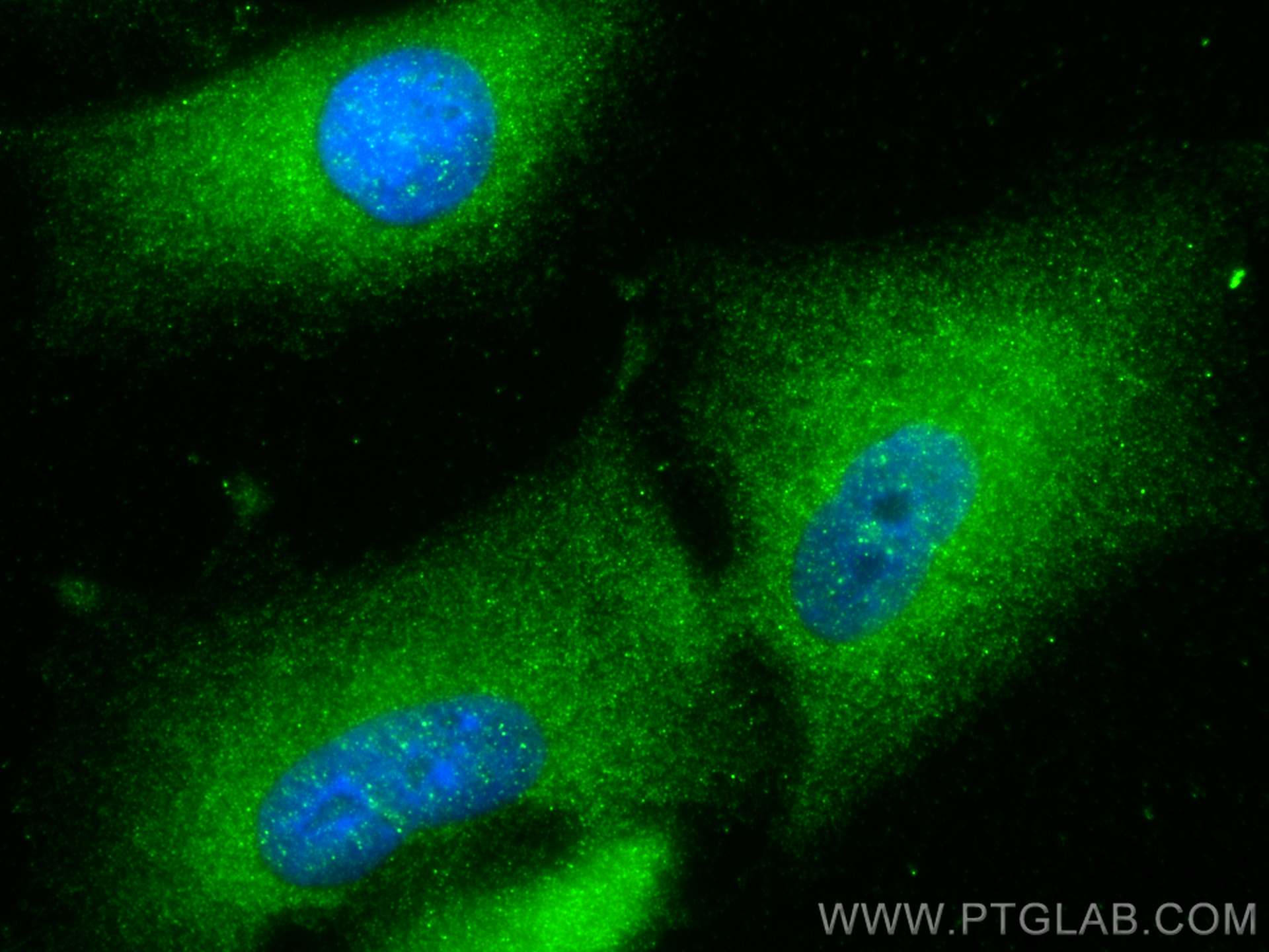 Immunofluorescence (IF) / fluorescent staining of A549 cells using ACOT4 Polyclonal antibody (17316-1-AP)