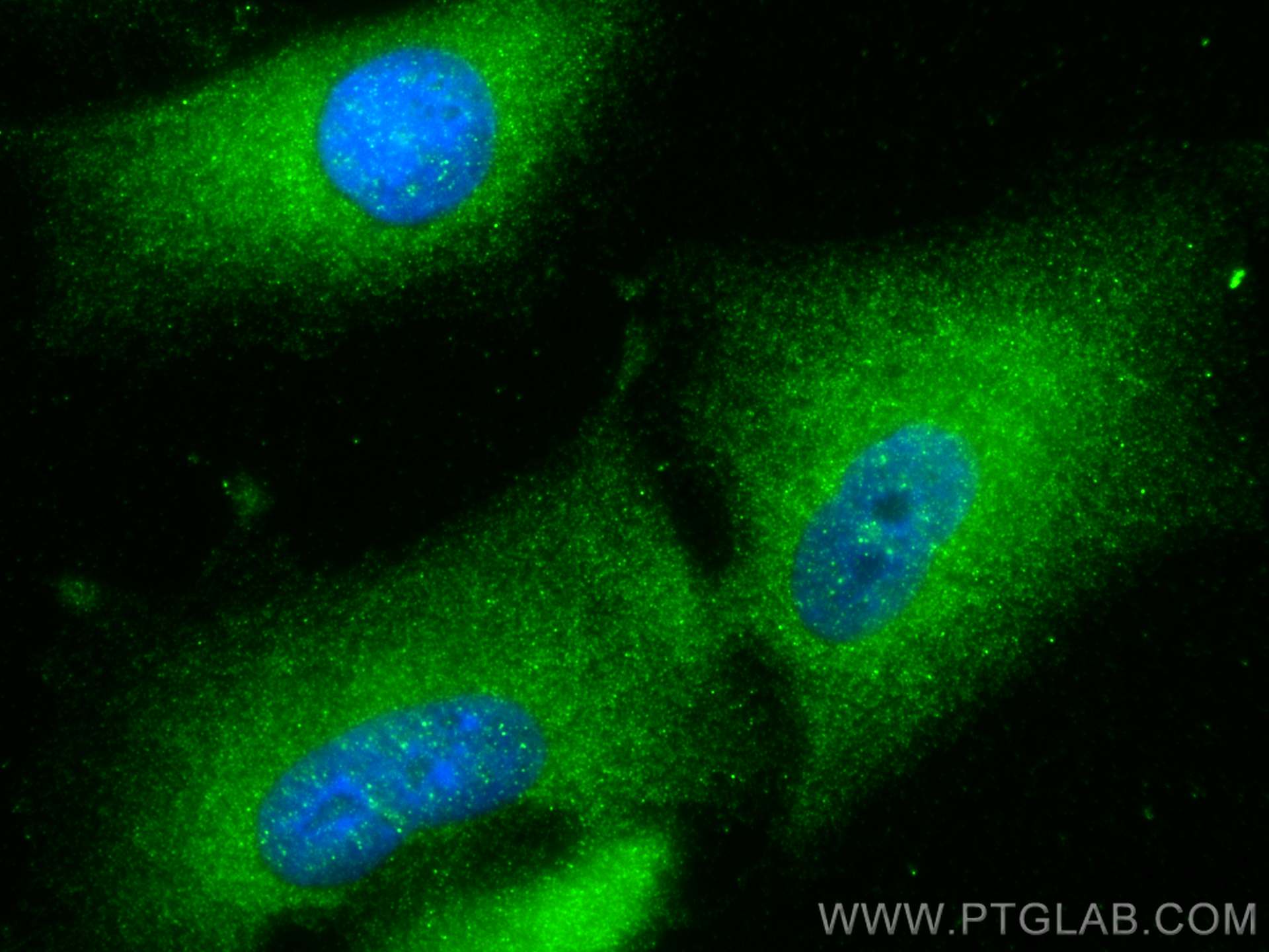 IF Staining of A549 using 17316-1-AP