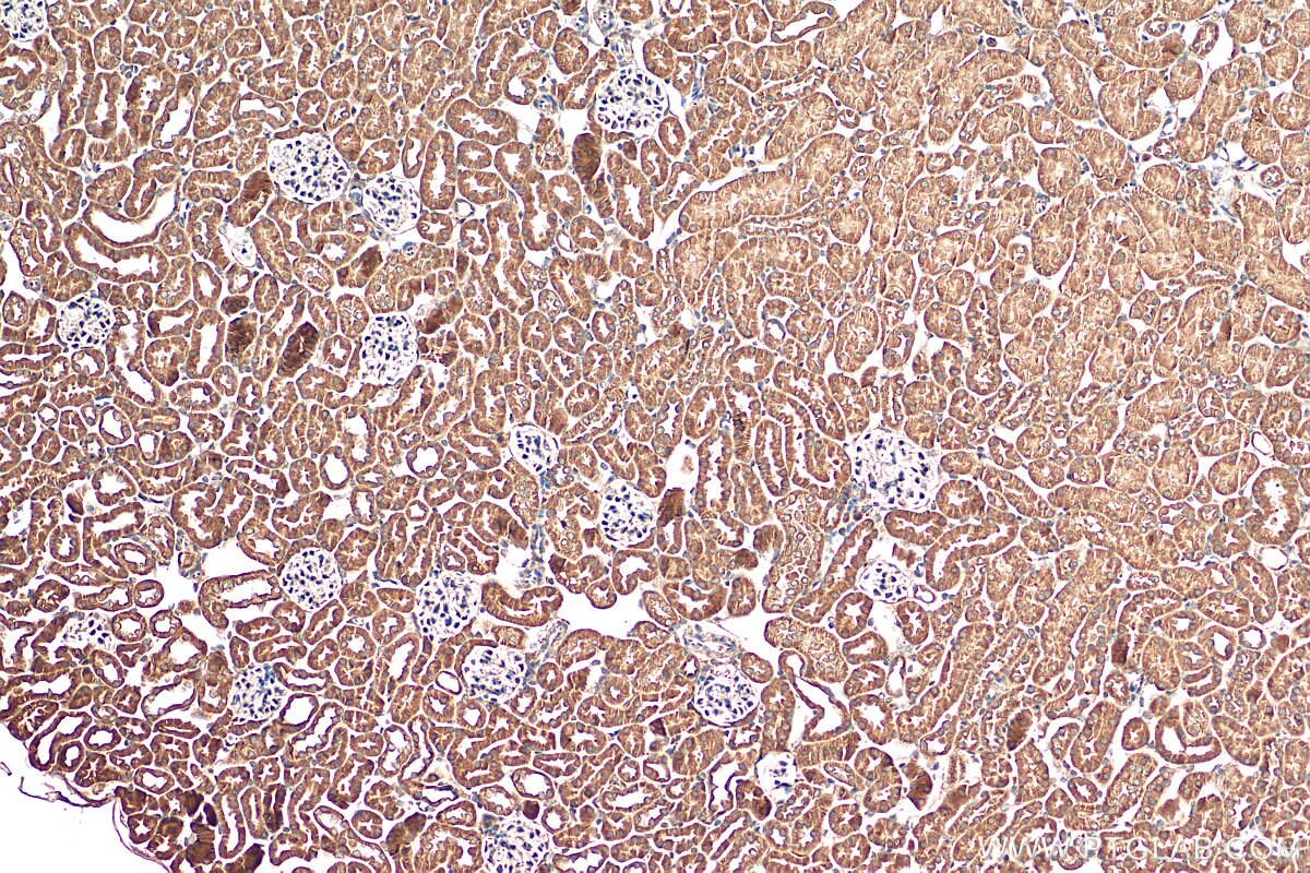 Immunohistochemistry (IHC) staining of mouse kidney tissue using ACOT4 Polyclonal antibody (17316-1-AP)