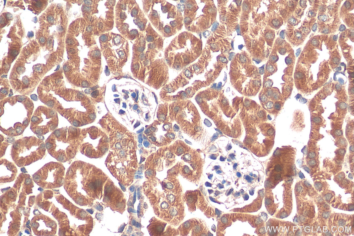 Immunohistochemistry (IHC) staining of mouse kidney tissue using ACOT4 Polyclonal antibody (17316-1-AP)