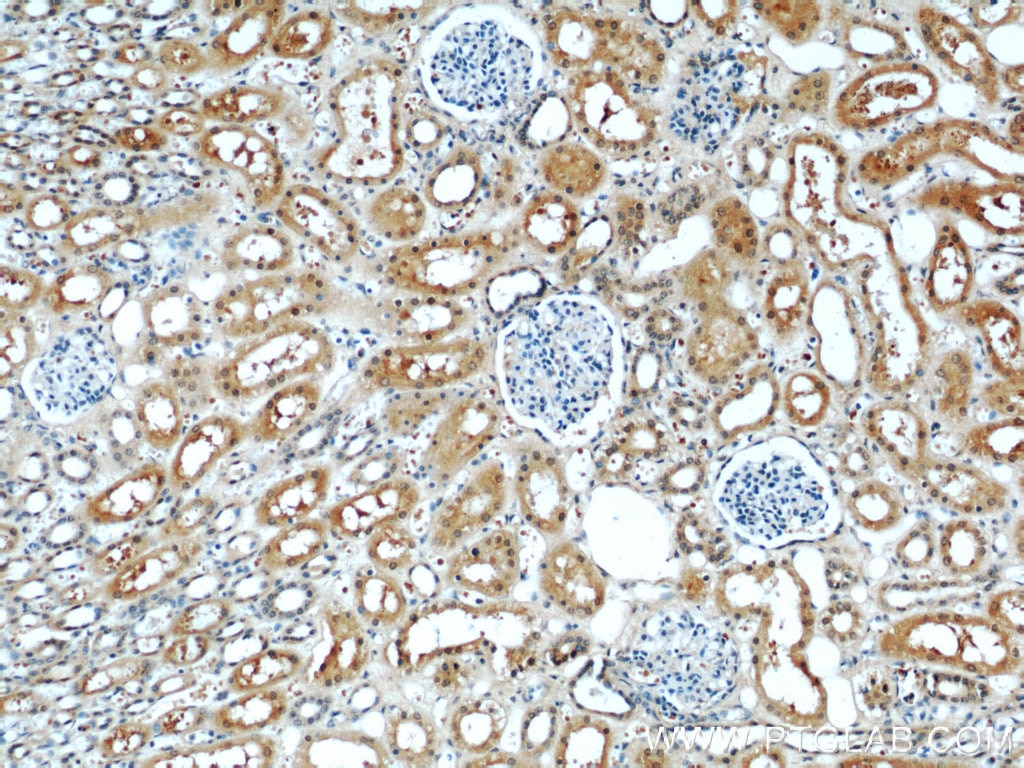 Immunohistochemistry (IHC) staining of human kidney tissue using ACOT6 Polyclonal antibody (22936-1-AP)