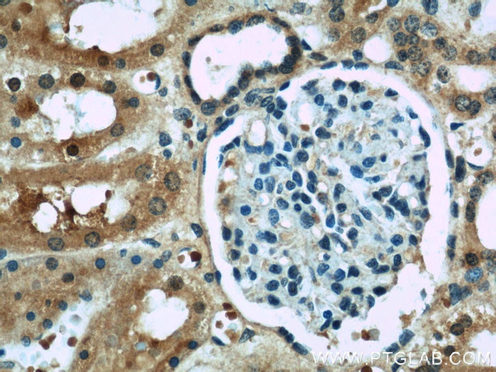 Immunohistochemistry (IHC) staining of human kidney tissue using ACOT6 Polyclonal antibody (22936-1-AP)
