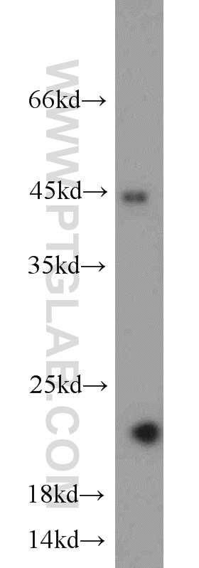 Western Blot (WB) analysis of HeLa cells using ACOT6 Polyclonal antibody (22936-1-AP)