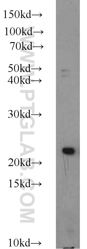 Western Blot (WB) analysis of HeLa cells using ACOT6 Polyclonal antibody (22936-1-AP)