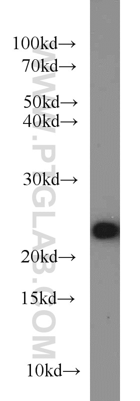Western Blot (WB) analysis of mouse liver tissue using ACOT6 Polyclonal antibody (22936-1-AP)