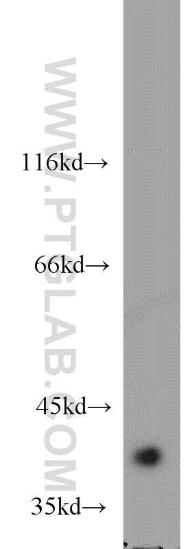 Western Blot (WB) analysis of mouse brain tissue using ACOT7 Polyclonal antibody (15972-1-AP)