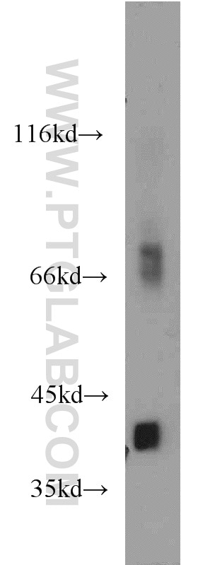 Western Blot (WB) analysis of human brain tissue using ACOT7 Polyclonal antibody (15972-1-AP)