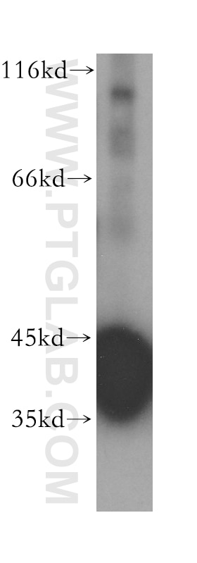 Western Blot (WB) analysis of human brain tissue using ACOT7 Polyclonal antibody (15972-1-AP)