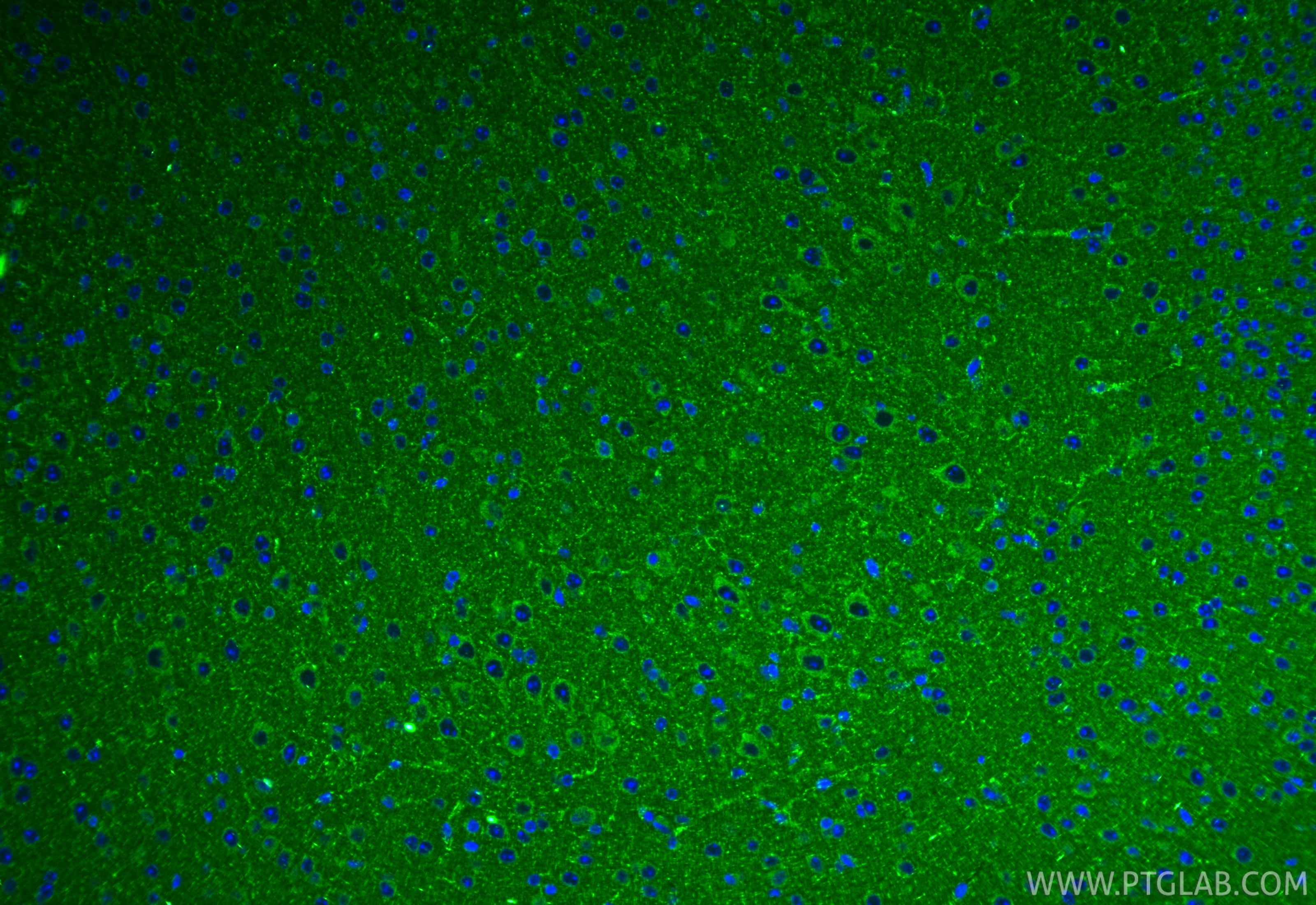 IF Staining of mouse brain using 15901-1-AP Immunofluorescence (IF) / fluorescent staining of mouse brain tissue using ACOT9 Polyclonal antibody (15901-1-AP)