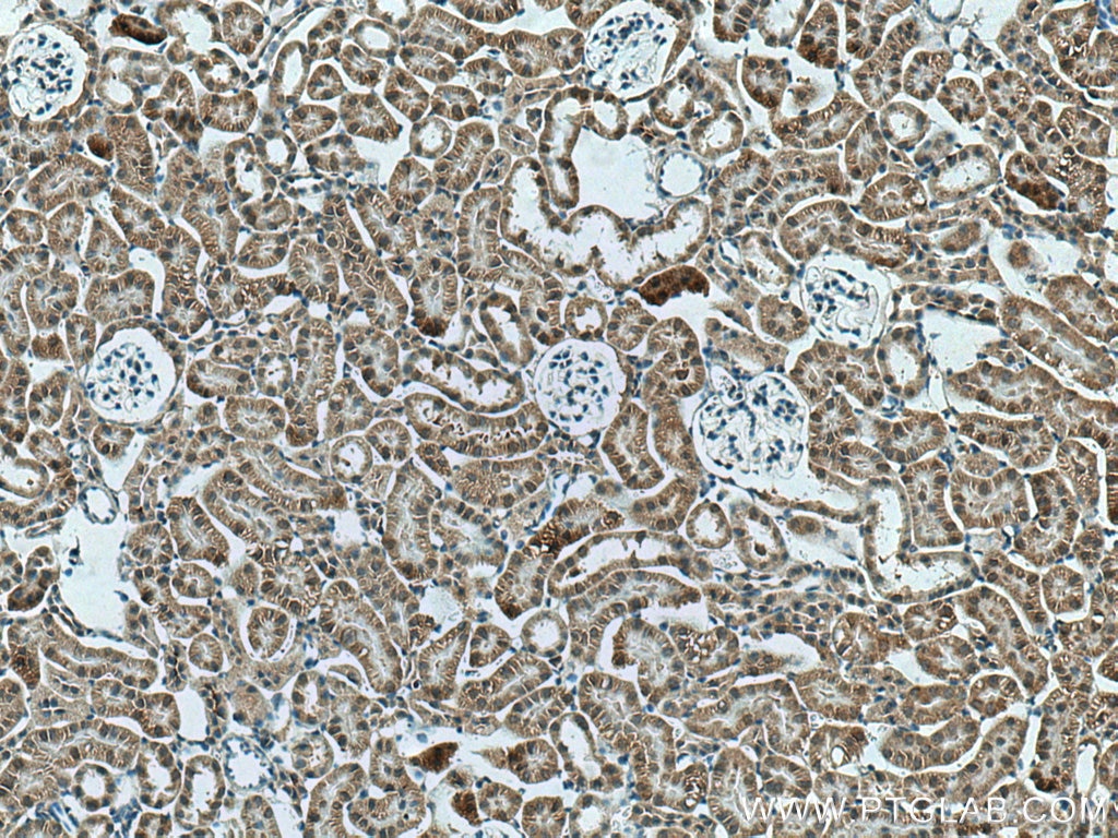 Immunohistochemistry (IHC) staining of mouse kidney tissue using ACOT9 Polyclonal antibody (15901-1-AP)