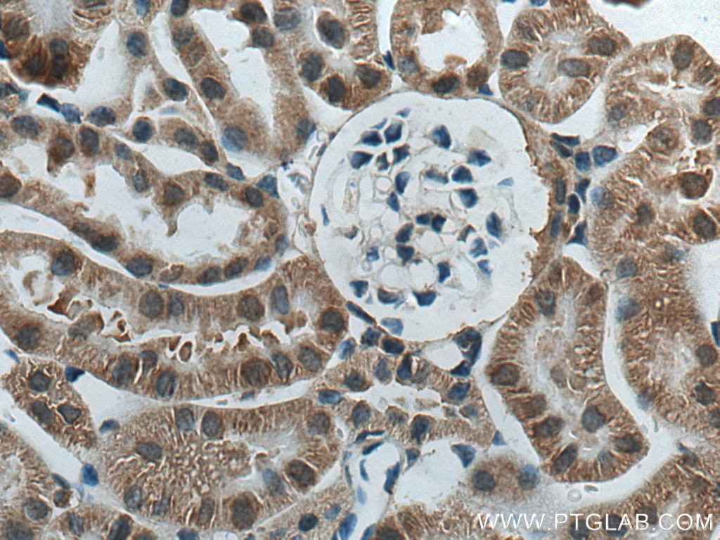 Immunohistochemistry (IHC) staining of mouse kidney tissue using ACOT9 Polyclonal antibody (15901-1-AP)